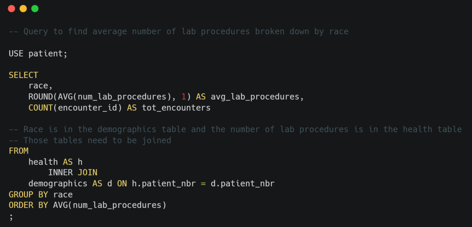 SQL code